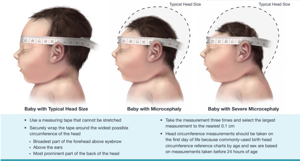 Measuring Head Circumference – Richmond Hill Children's Clinic